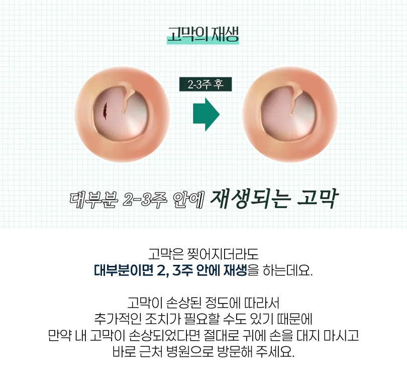 소음성 난청 11