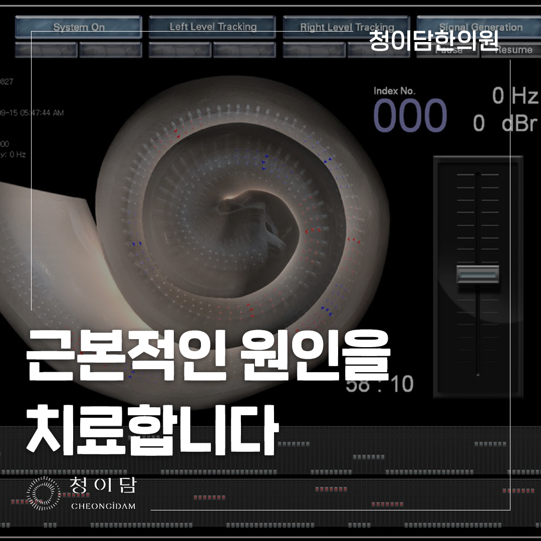 소음성 난청 치료 추가 소음 노출을 줄이는 것부터 시작합니다